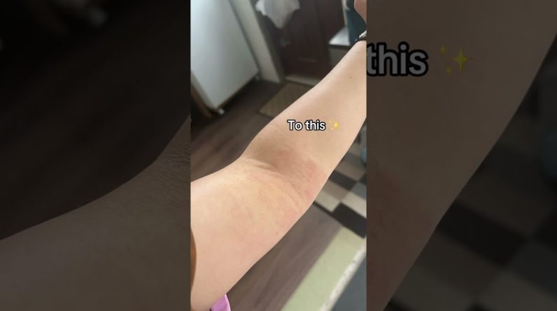 1765859756 maxresdefault