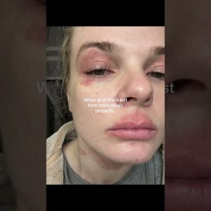 1765865457 maxresdefault