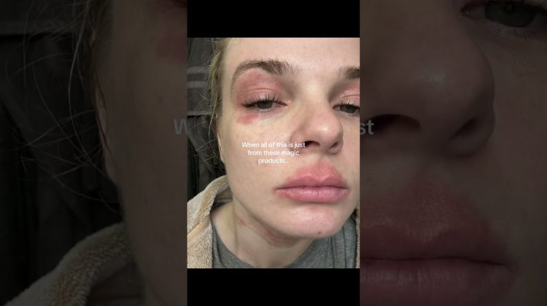 1765865457 maxresdefault