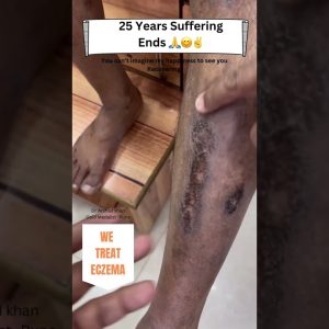 1765874402 maxresdefault