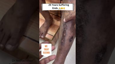 1765874402 maxresdefault