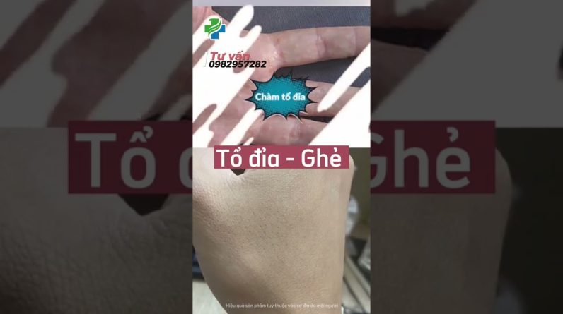 1765876204 maxresdefault