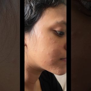 1765884597 maxresdefault