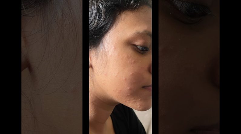 1765884597 maxresdefault