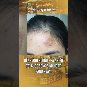 1765887224 maxresdefault