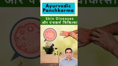 1765892172 maxresdefault