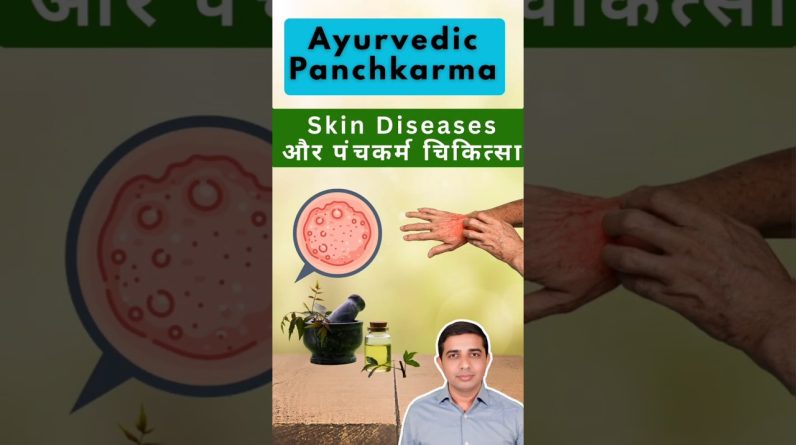 1765892172 maxresdefault