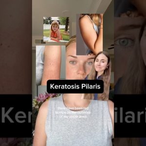 1765894687 maxresdefault