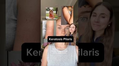 1765894687 maxresdefault