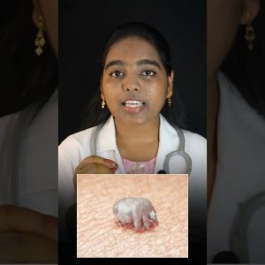 1765895711 maxresdefault