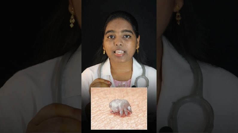 1765895711 maxresdefault