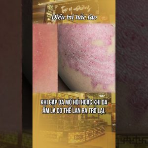 1765898217 maxresdefault