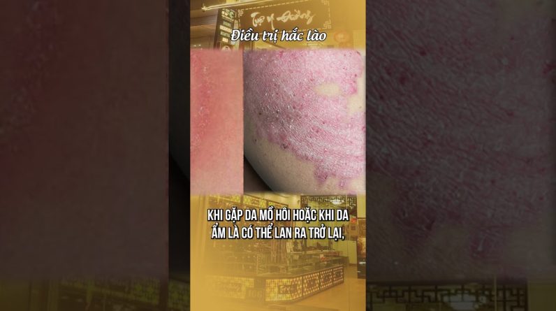 1765898217 maxresdefault