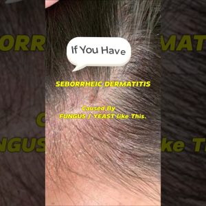 1765903015 maxresdefault