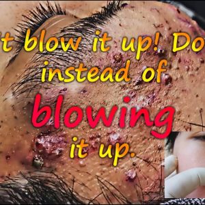 1765913003 maxresdefault