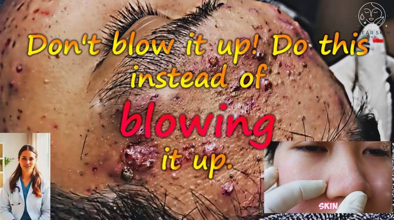 1765913003 maxresdefault