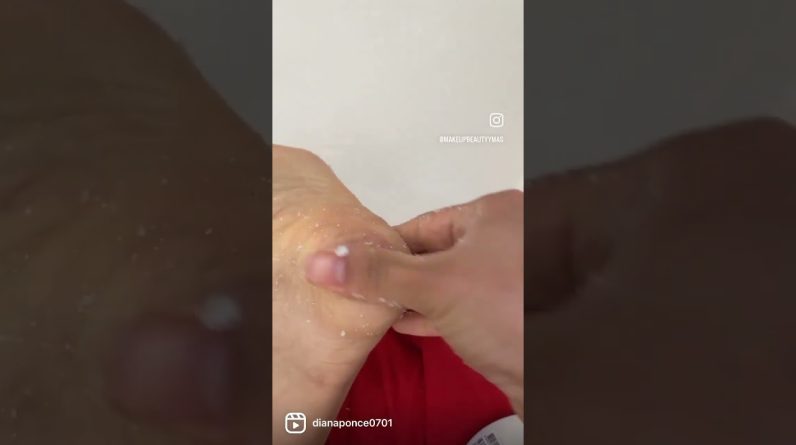 1765928704 maxresdefault