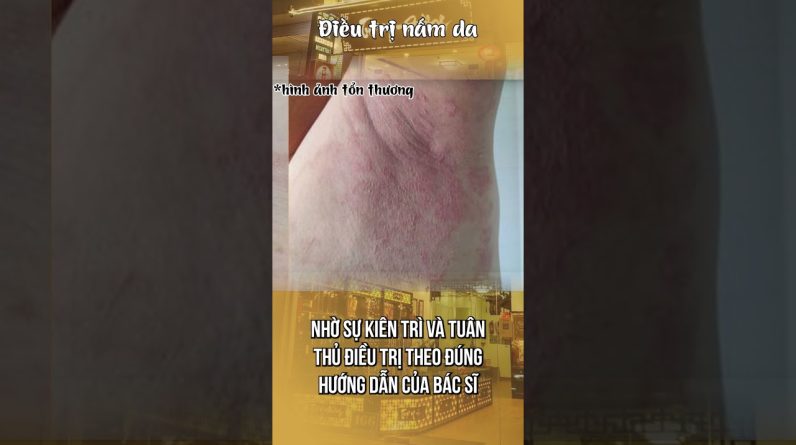 1765938477 maxresdefault