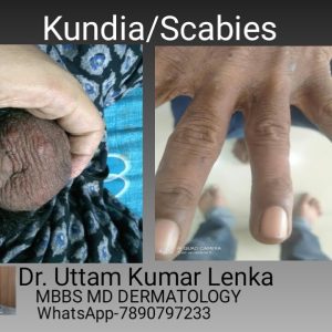 1765943335 maxresdefault