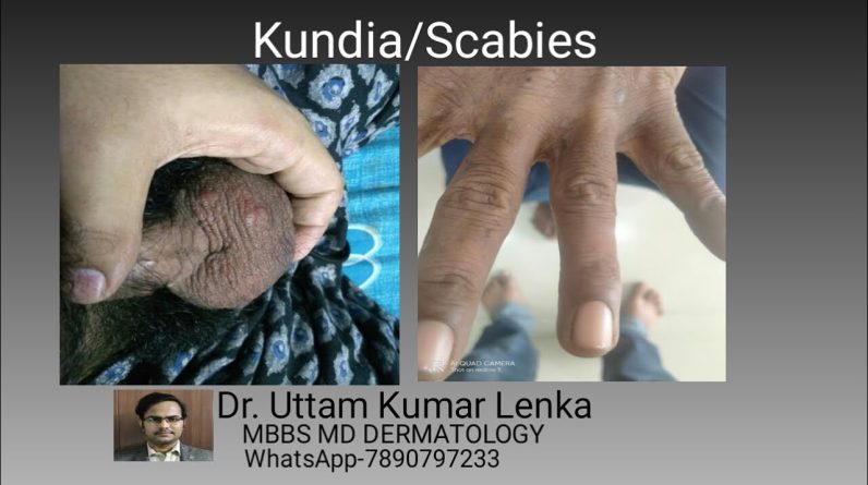 1765943335 maxresdefault