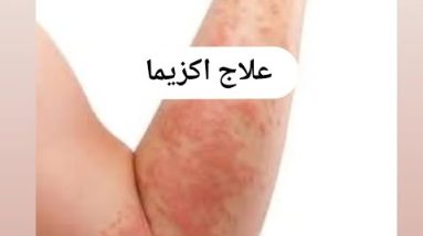 1765951255 hqdefault