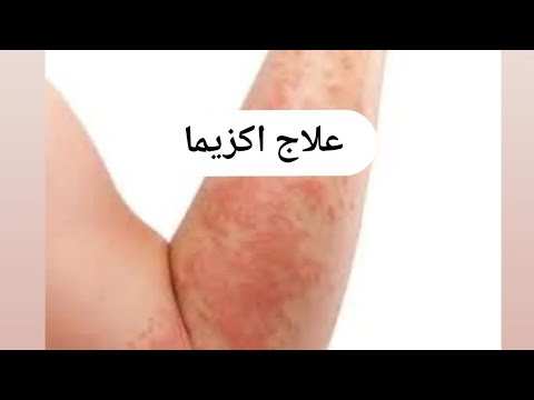 1765951255 hqdefault