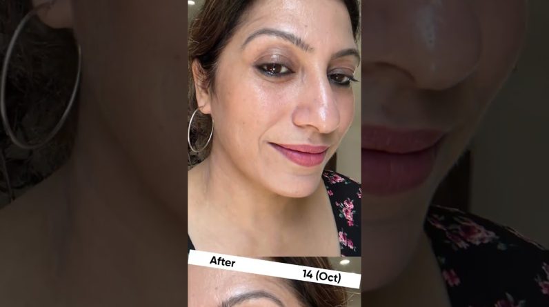 1765964101 maxresdefault