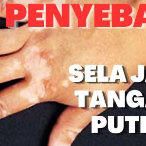 1765975185 maxresdefault