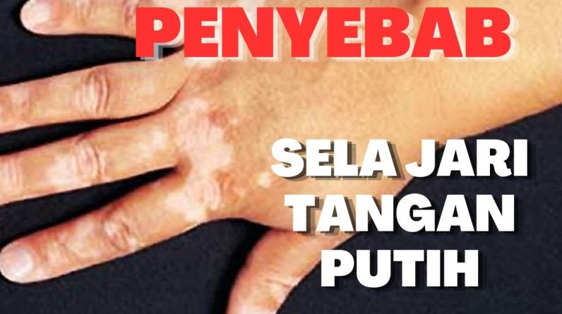 1765975185 maxresdefault