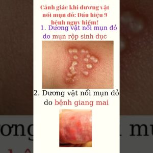 1765982458 maxresdefault