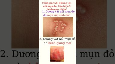 1765982458 maxresdefault