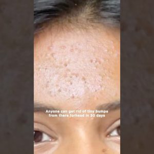 1765987149 maxresdefault