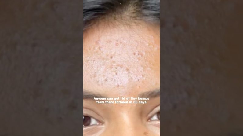 1765987149 maxresdefault