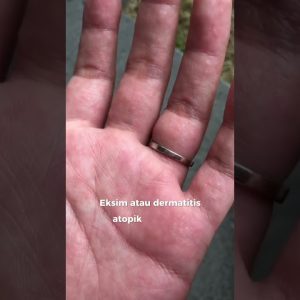 1765993625 maxresdefault