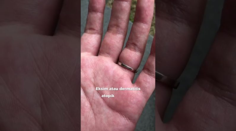 1765993625 maxresdefault