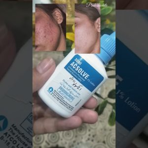 1765998115 maxresdefault