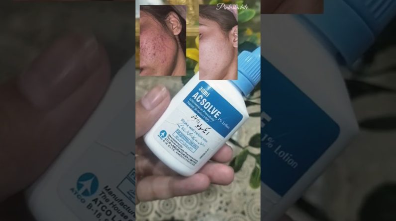 1765998115 maxresdefault