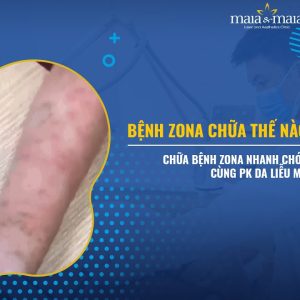 1766000732 maxresdefault