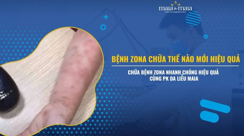 1766000732 maxresdefault