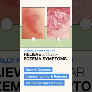 1766000978 maxresdefault