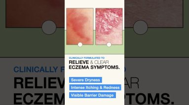 1766000978 maxresdefault