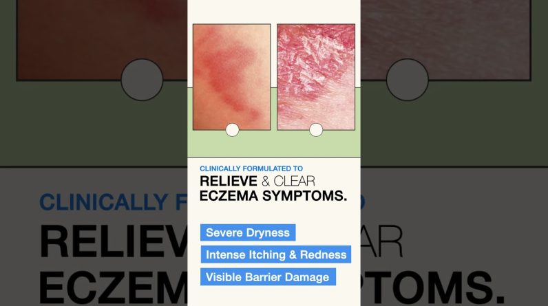 1766000978 maxresdefault