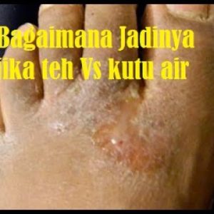 1766004368 hqdefault