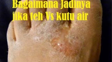 1766004368 hqdefault