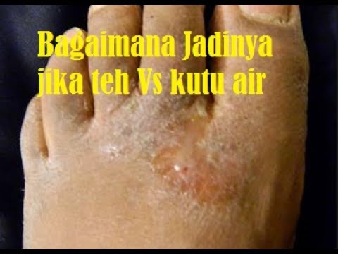 1766004368 hqdefault