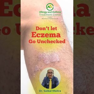 1766006318 maxresdefault