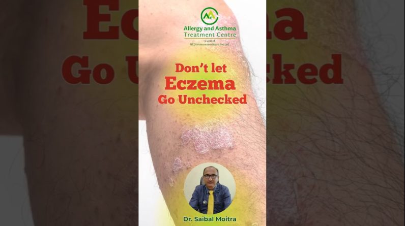 1766006318 maxresdefault