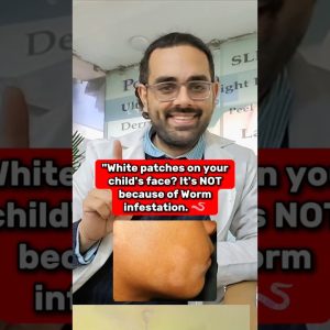 1766008025 maxresdefault