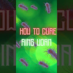 1766011716 maxresdefault