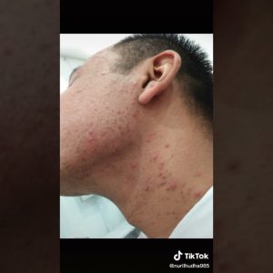 1766015364 maxresdefault